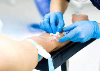 Odtrucia alkoholowe Kraków – wstęp do zmiany stylu życia