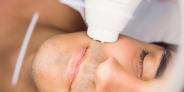 Dlaczego warto skorzystać z lasera podczas usuwania blizn?